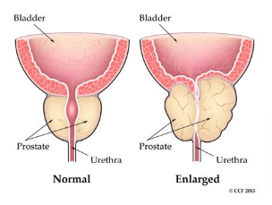 ProstaMend Tablets